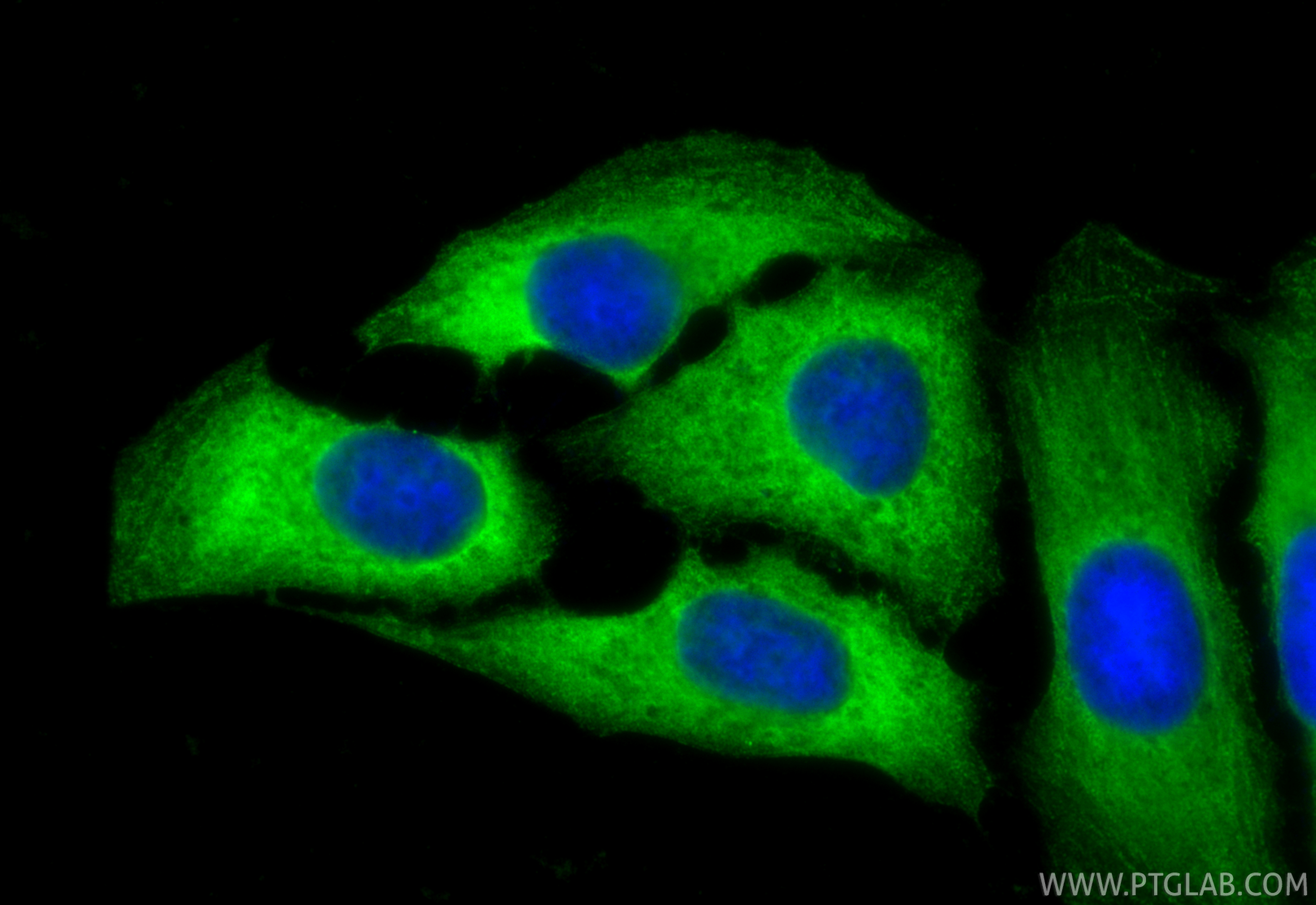 IF Staining of U2OS using 11128-1-AP IF Staining of U2OS using 11128-1-AP