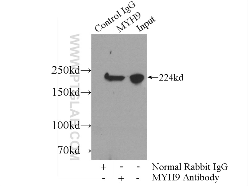 IP experiment of mouse brain using 11128-1-AP