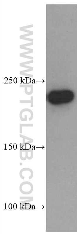 WB analysis of mouse kidney using 60233-1-Ig