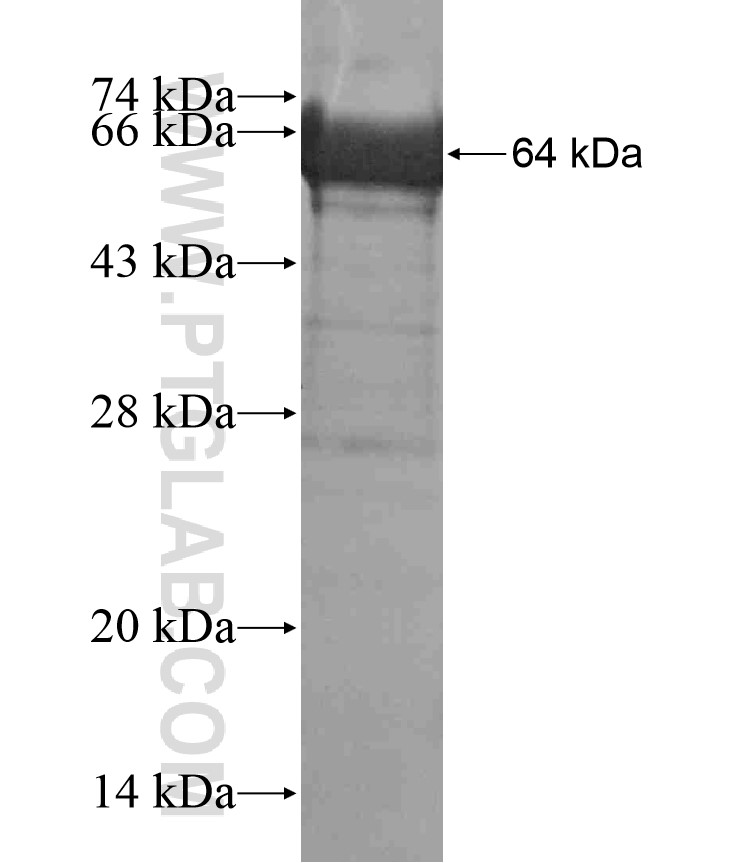 MYH9 fusion protein Ag17971 SDS-PAGE MYH9 fusion protein Ag17971 SDS-PAGE