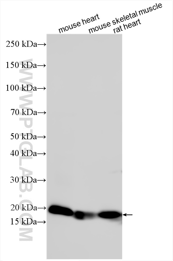 Various lysates were subjected to SDS PAGE followed by western blot with 15396-1-AP (MYL10 antibody) at dilution of 1:10000 incubated at room temperature for 1.5 hours. WB analysis using 15396-1-AP