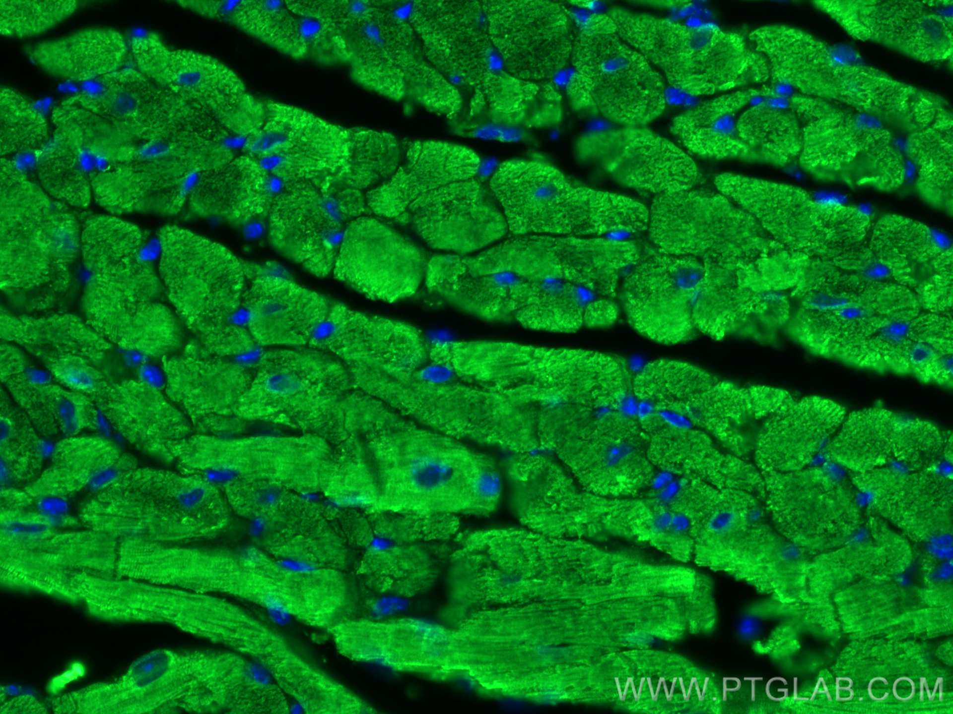 IF Staining of mouse heart using 10906-1-AP
