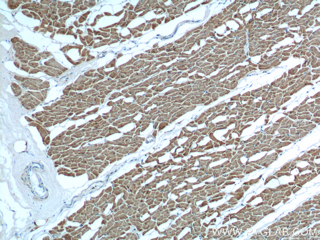 IHC staining of human heart using 10906-1-AP