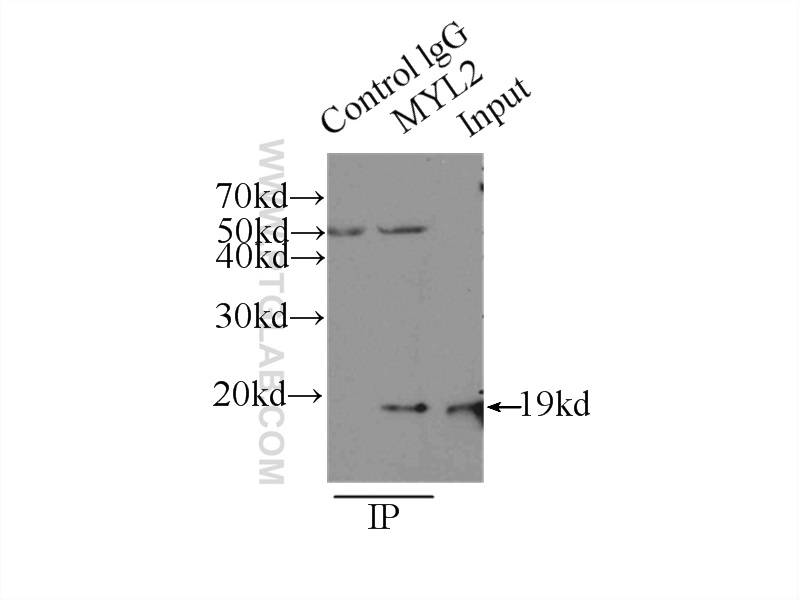 IP experiment of mouse heart using 10906-1-AP