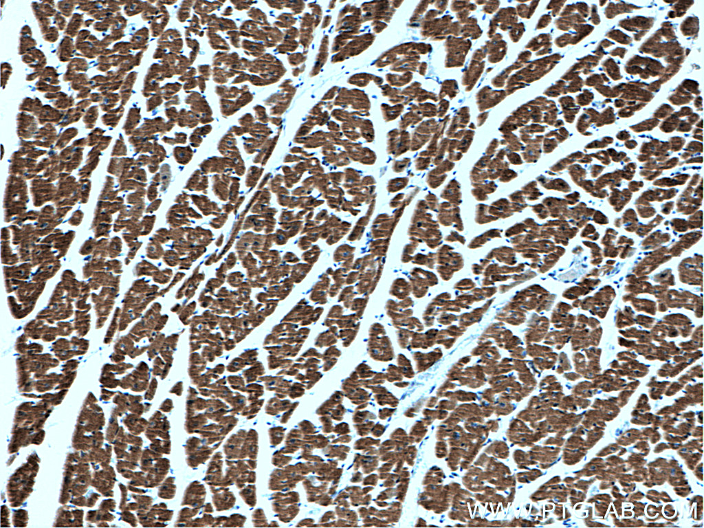 IHC staining of human heart using 60229-1-Ig (same clone as 60229-1-PBS)