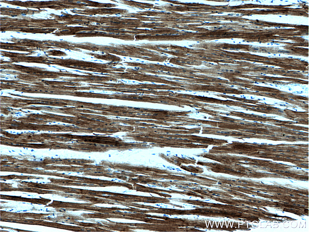 IHC staining of human heart using 60229-1-Ig (same clone as 60229-1-PBS)