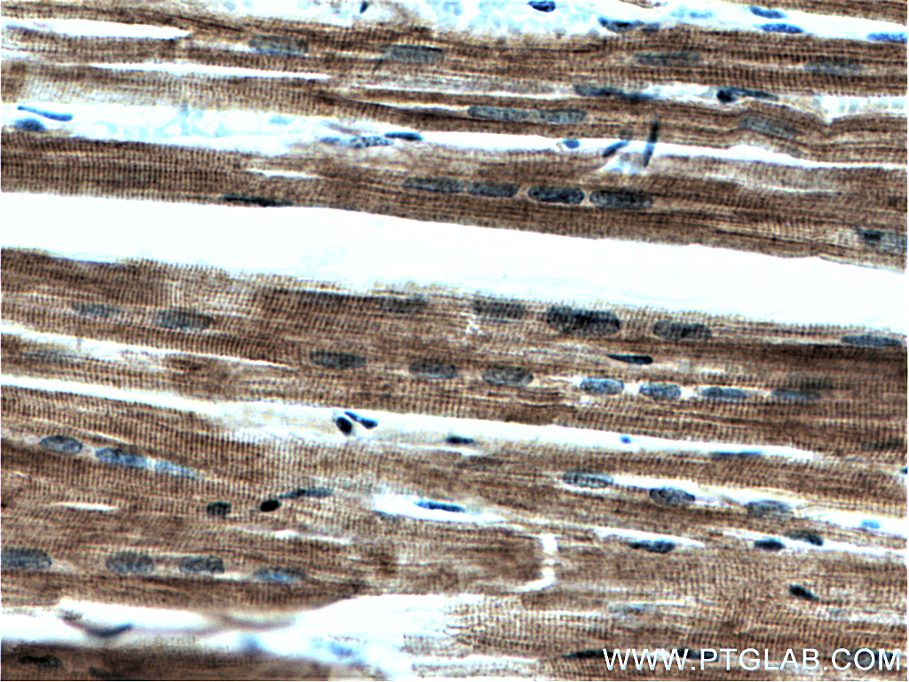 IHC staining of human heart using 60229-1-Ig (same clone as 60229-1-PBS)