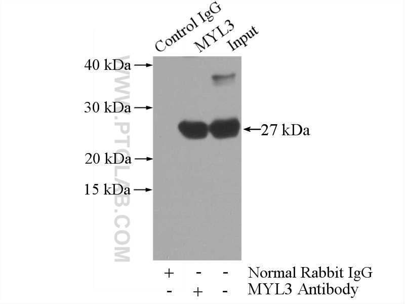 IP experiment of mouse heart using 10913-1-AP