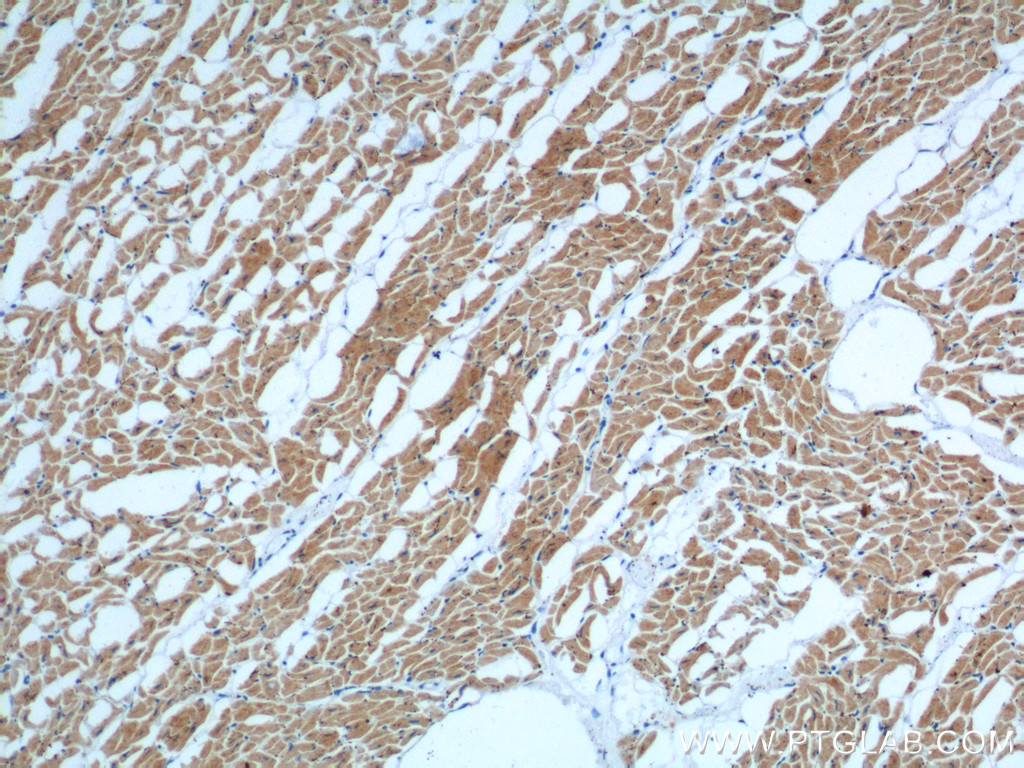 IHC staining of human heart using 66286-1-Ig