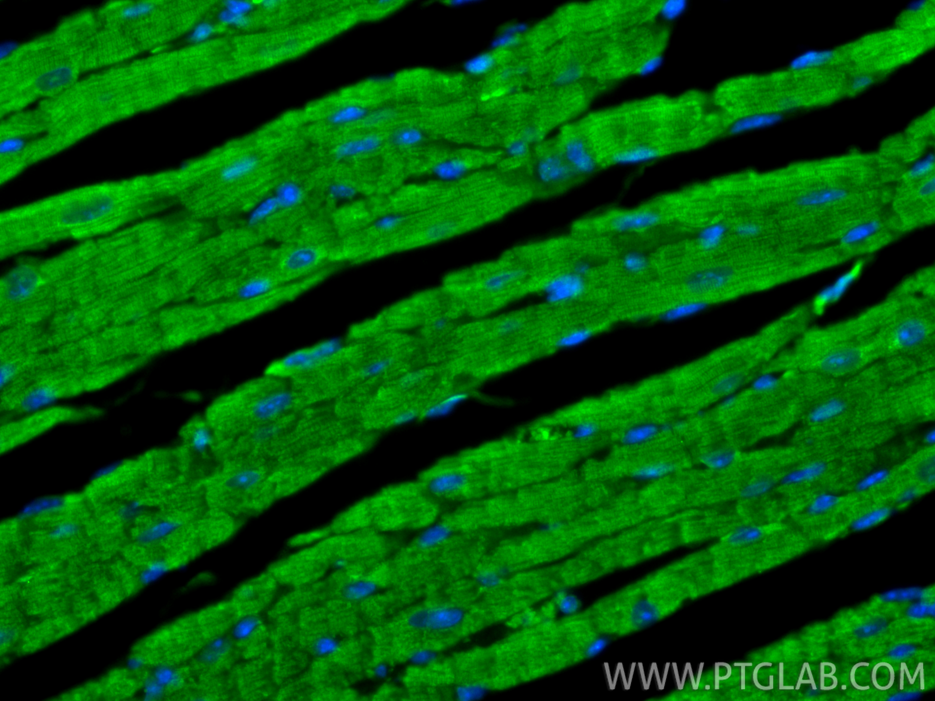 IF Staining of mouse heart using 13229-1-AP