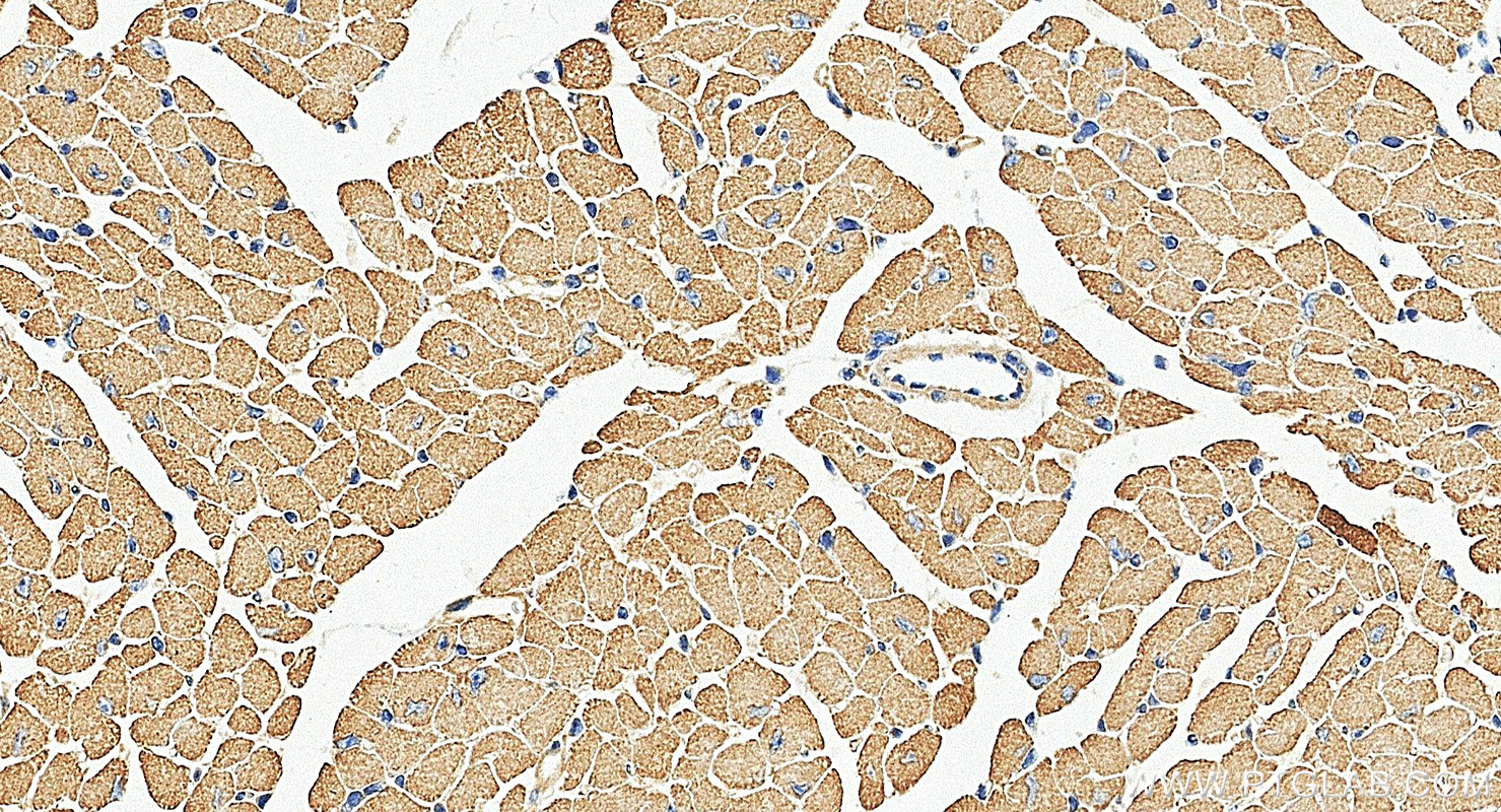 IHC staining of mouse heart using 13229-1-AP