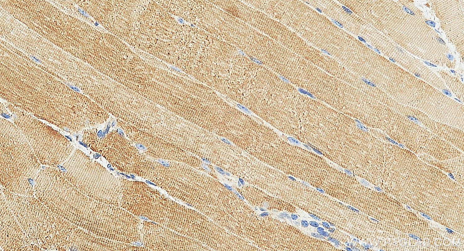 IHC staining of mouse skeletal muscle using 13229-1-AP