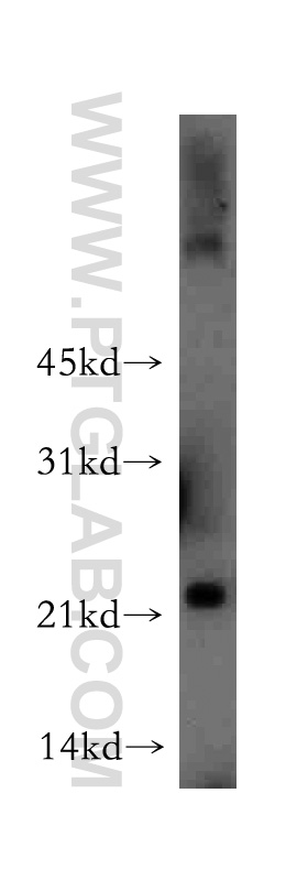 WB analysis of human liver using 13229-1-AP