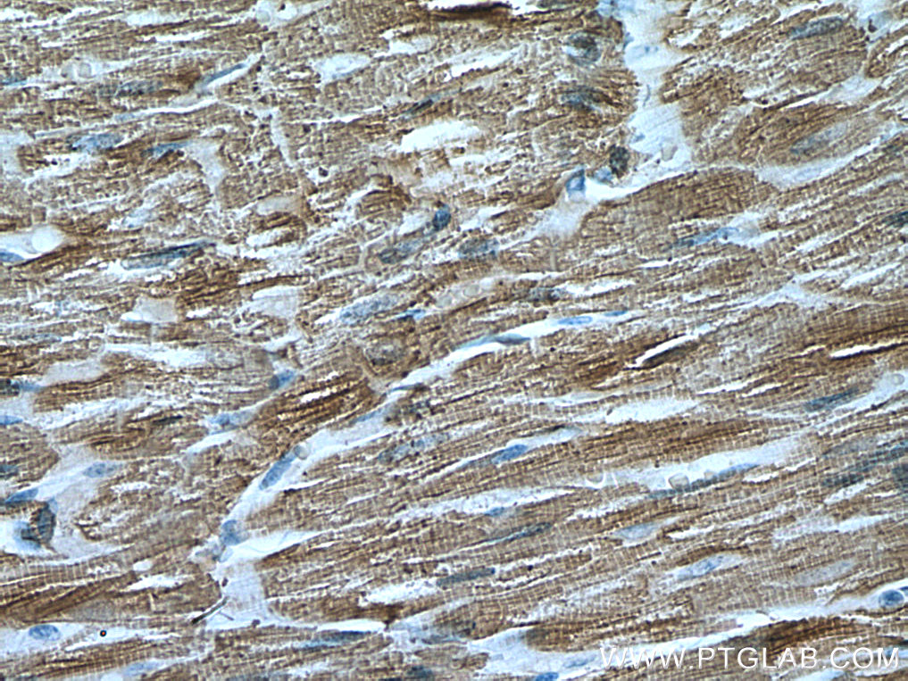 IHC staining of human heart using 67533-1-Ig (same clone as 67533-1-PBS)