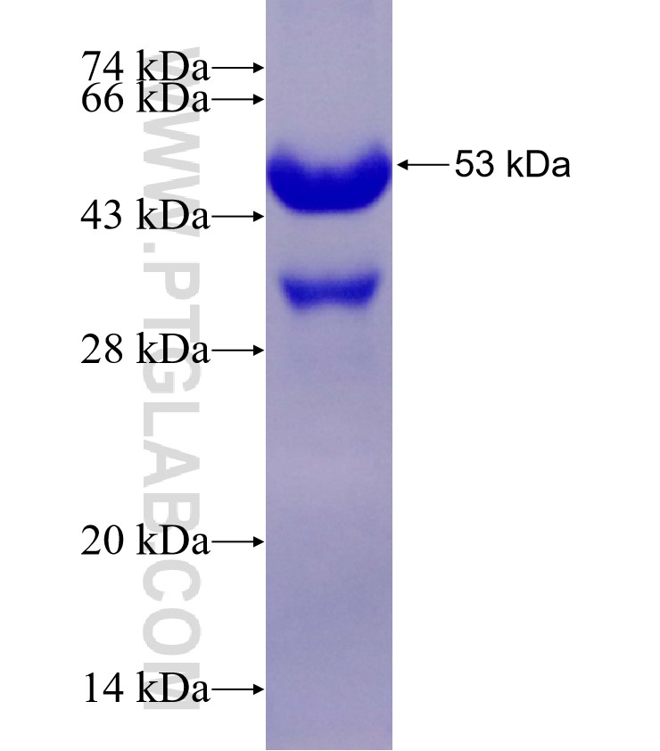 MYL4 fusion protein Ag4031 SDS-PAGE