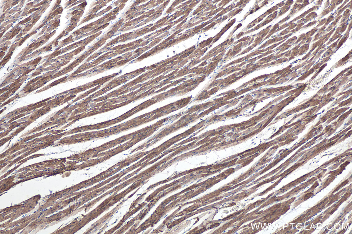 IHC staining of rat heart using 68142-1-Ig