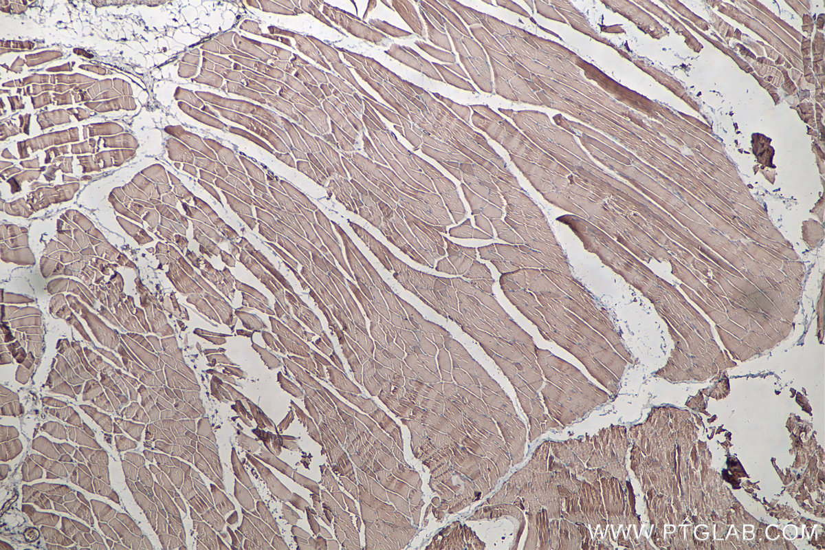 IHC staining of rat skeletal muscle using 68142-1-Ig