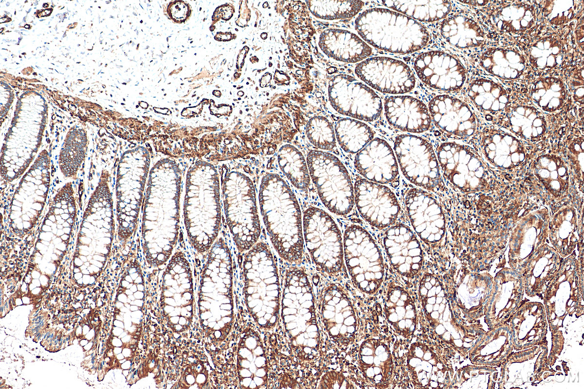 IHC staining of human colon using 68142-1-Ig