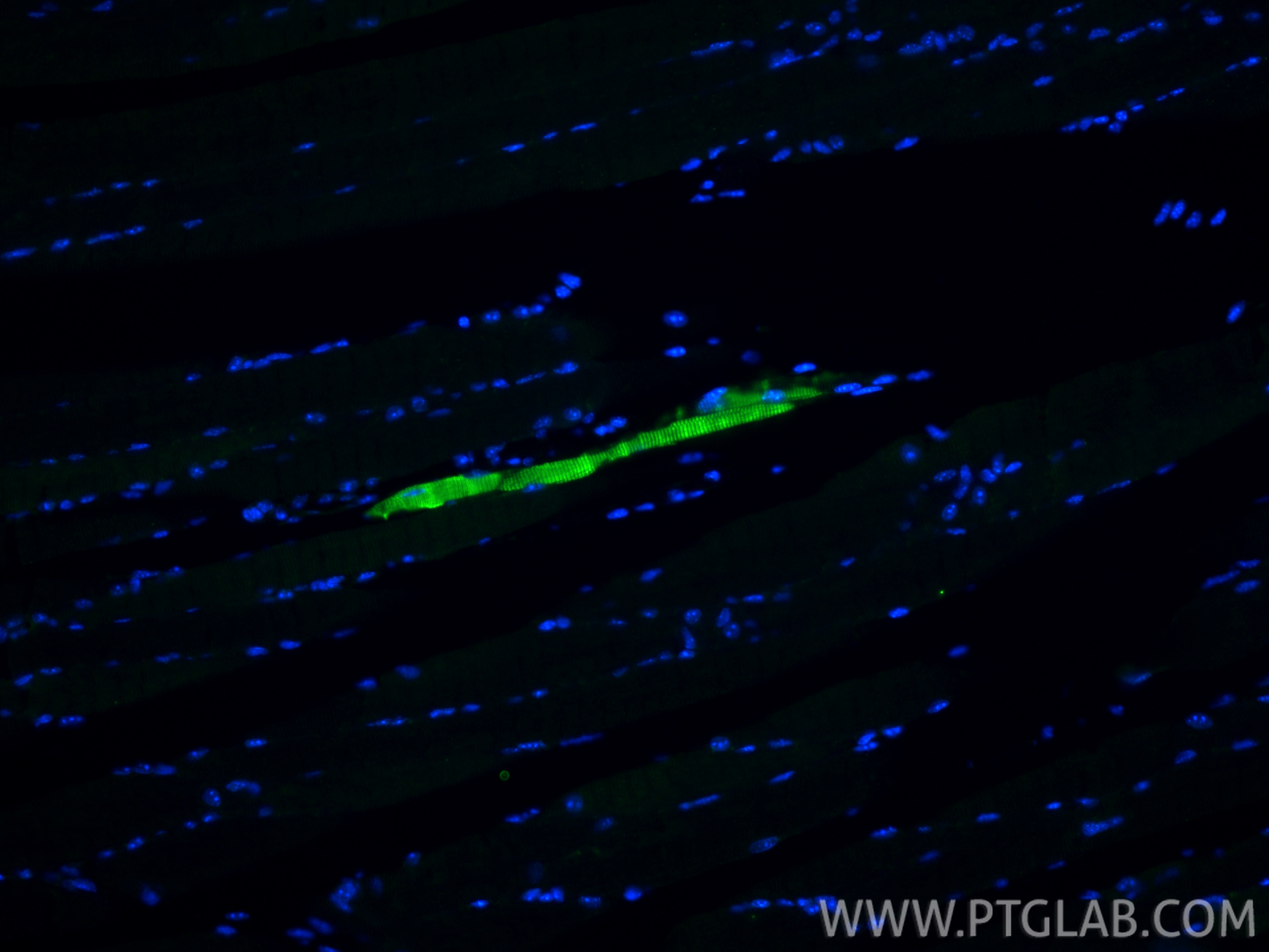 IF Staining of mouse skeletal muscle using 16963-1-AP