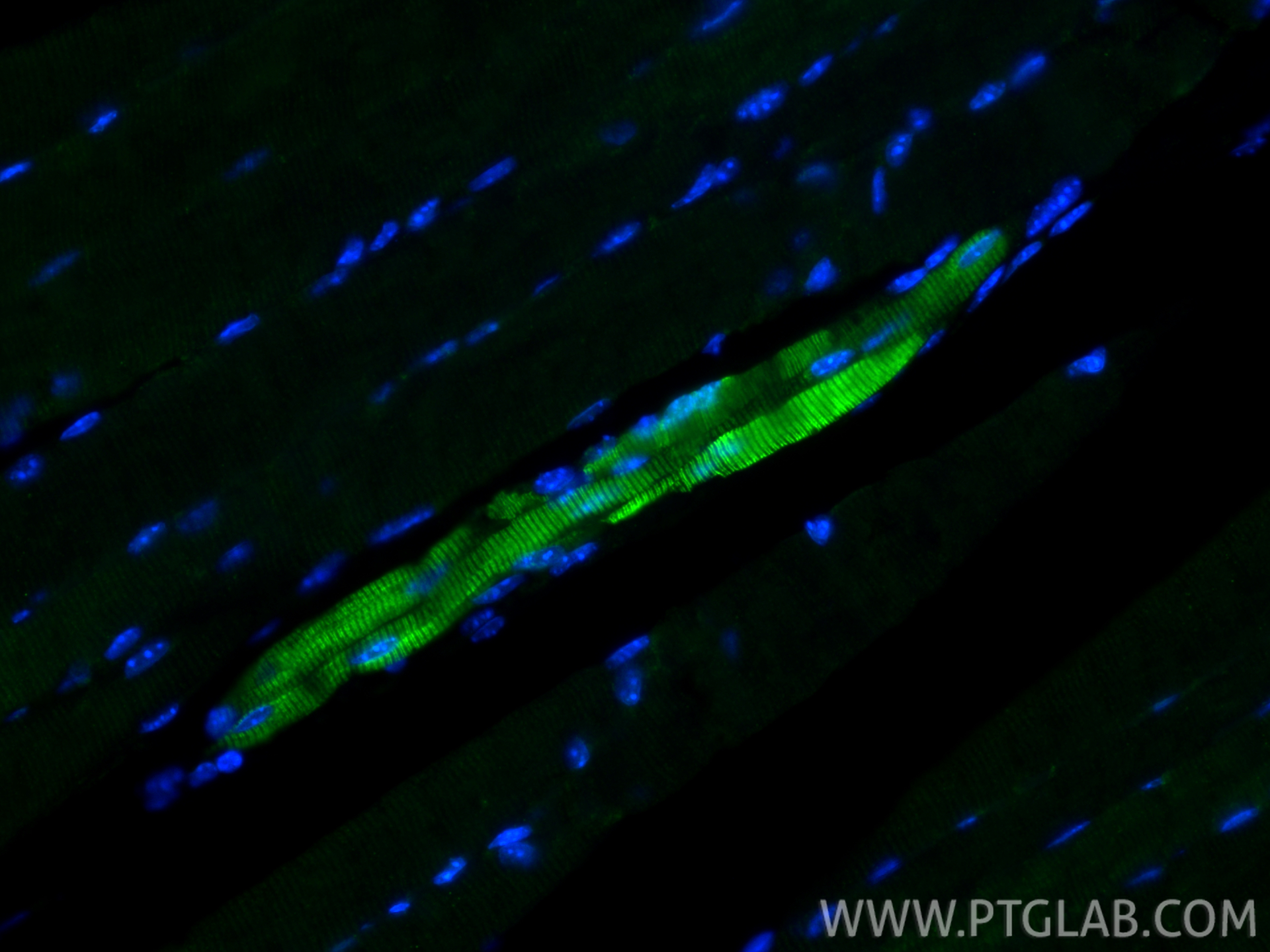 IF Staining of mouse skeletal muscle using 16963-1-AP