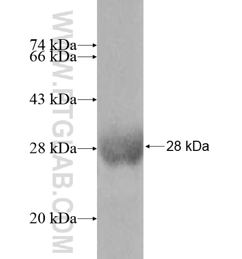 MYL6B fusion protein Ag10665 SDS-PAGE MYL6B fusion protein Ag10665 SDS-PAGE