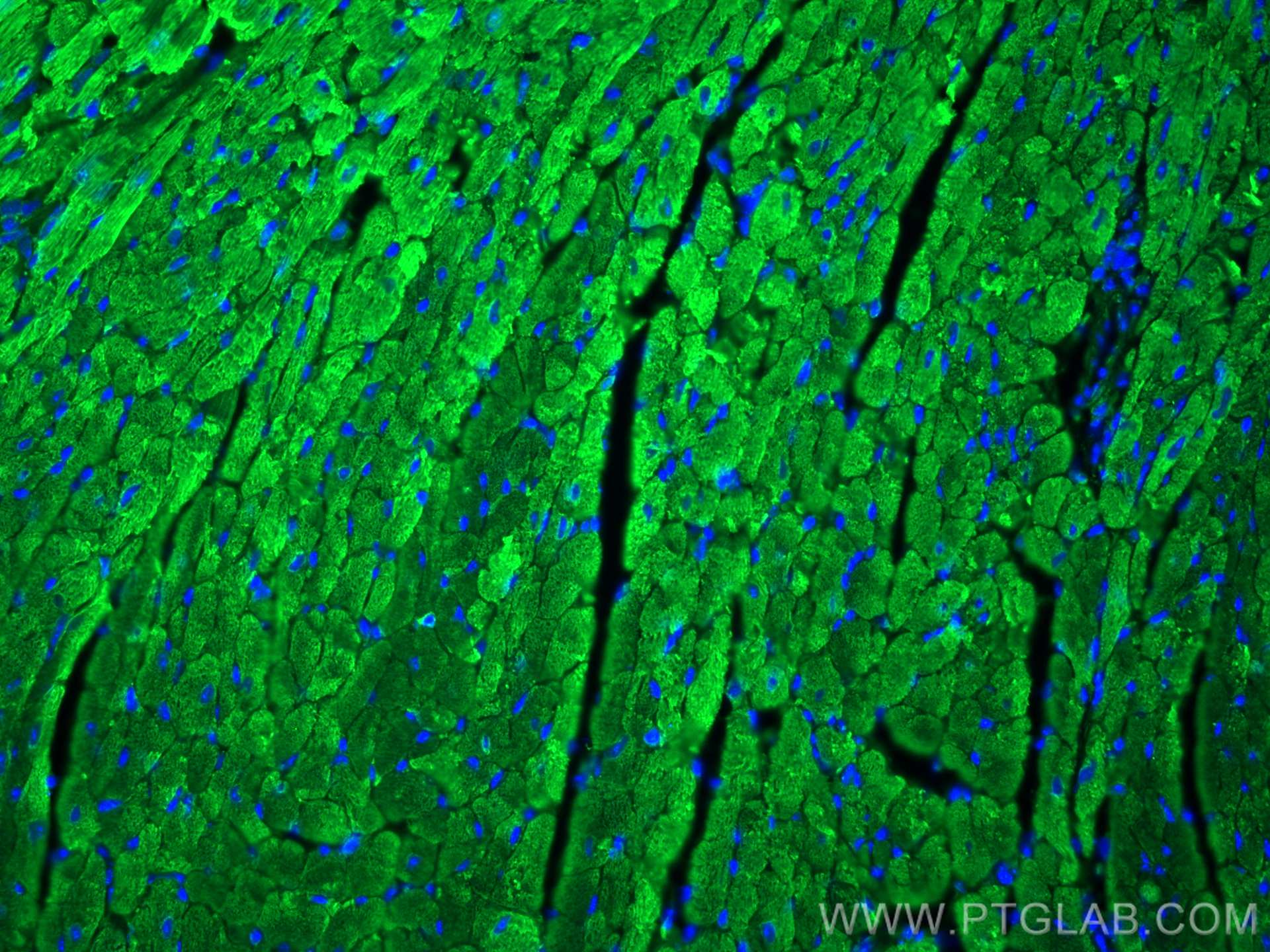 IF Staining of mouse heart using 17283-1-AP