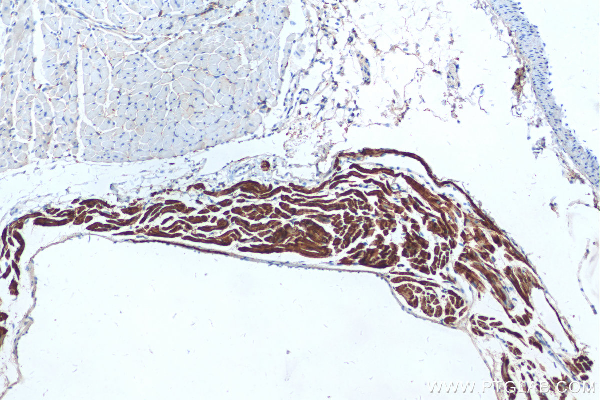 IHC staining of mouse heart using 81570-1-RR (same clone as 81570-1-PBS)