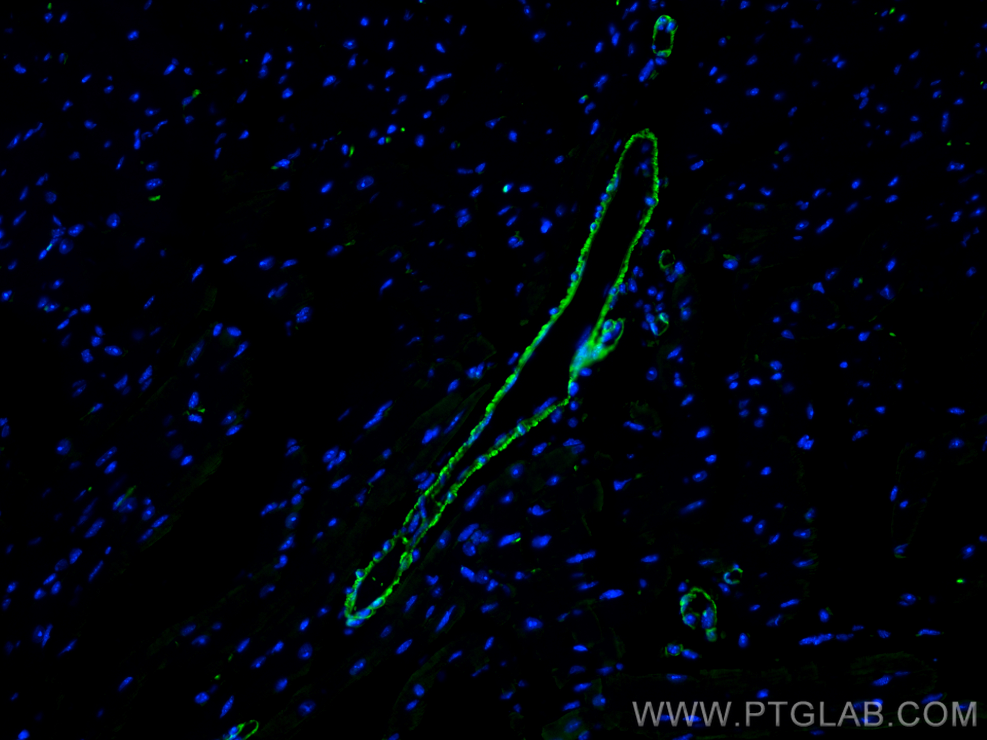 IF Staining of mouse heart using 15354-1-AP
