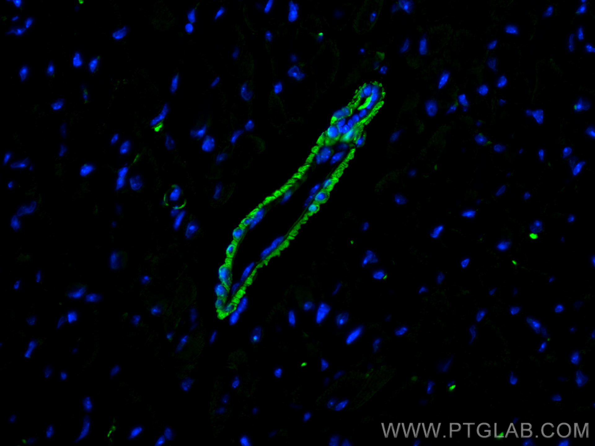 IF Staining of mouse heart using 15354-1-AP