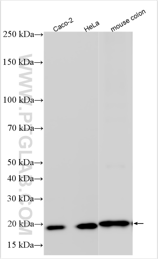 WB analysis using 15354-1-AP WB analysis using 15354-1-AP