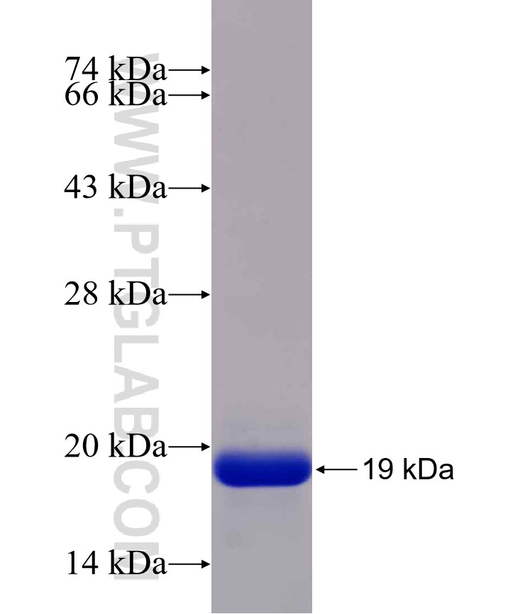 MYL9 fusion protein Ag7636 SDS-PAGE MYL9 fusion protein Ag7636 SDS-PAGE