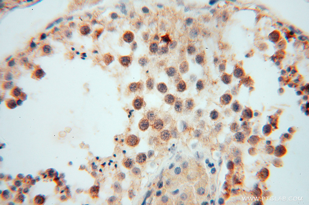 IHC staining of human testis using 15455-1-AP