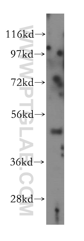 WB analysis of human cerebellum using 15455-1-AP