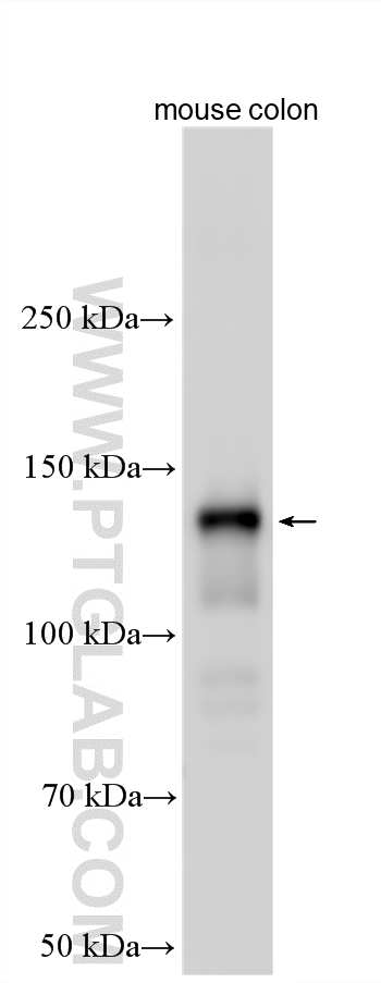 WB analysis using 21642-1-AP WB analysis using 21642-1-AP