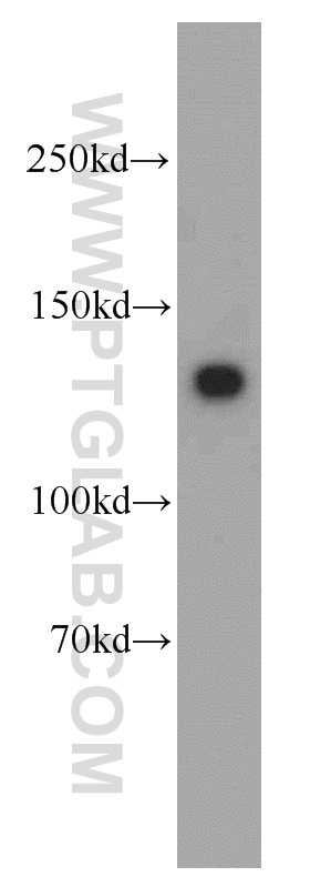 WB analysis of mouse uterus using 21642-1-AP