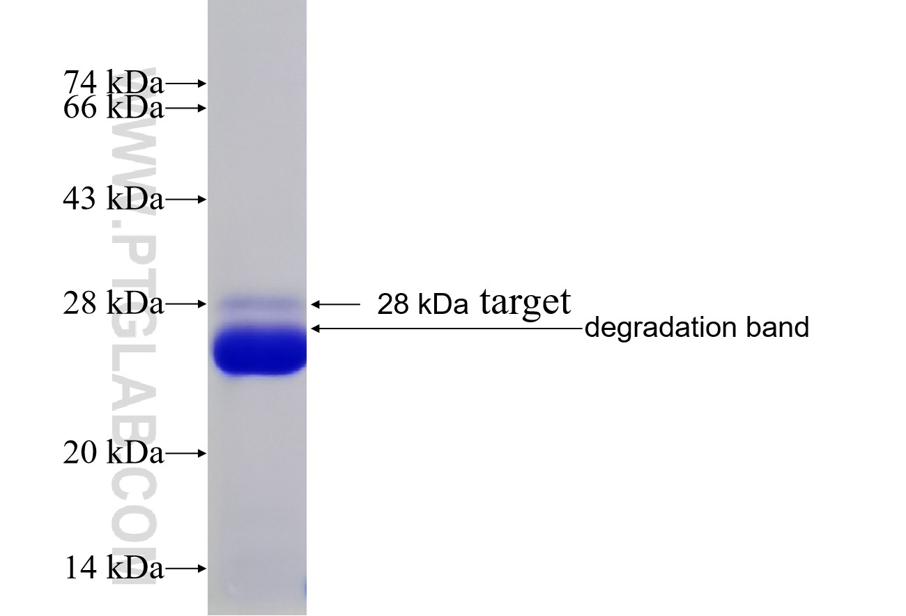 MYLK fusion protein Ag16710 SDS-PAGE MYLK fusion protein Ag16710 SDS-PAGE