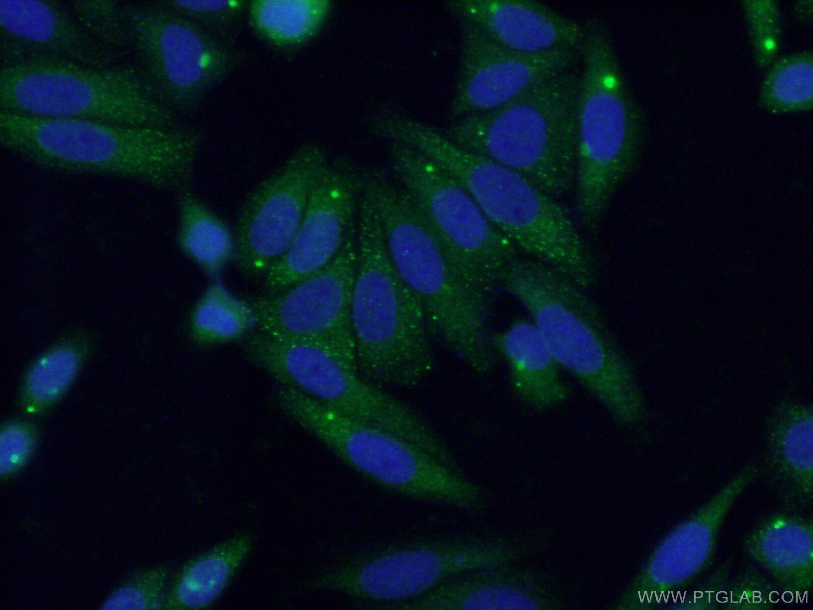 IF Staining of HepG2 using 21527-1-AP