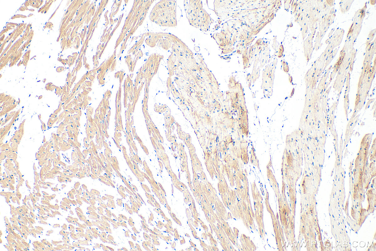 Immunohistochemical analysis of paraffin-embedded mouse heart tissue slide using 21527-1-AP (MYLK3 antibody) at dilution of 1:800 (under 10x lens). Heat mediated antigen retrieval with Tris-EDTA buffer (pH 9.0). IHC staining of mouse heart using 21527-1-AP