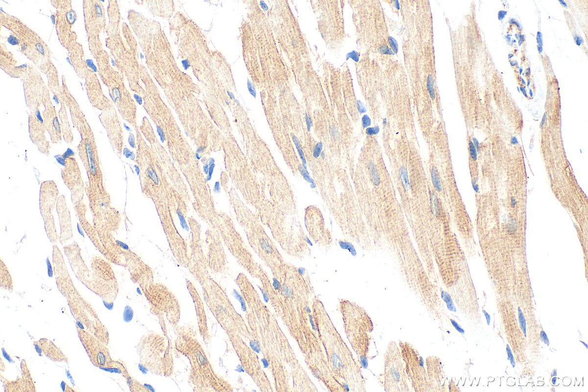 Immunohistochemical analysis of paraffin-embedded mouse heart tissue slide using 21527-1-AP (MYLK3 antibody) at dilution of 1:800 (under 40x lens). Heat mediated antigen retrieval with Tris-EDTA buffer (pH 9.0). IHC staining of mouse heart using 21527-1-AP