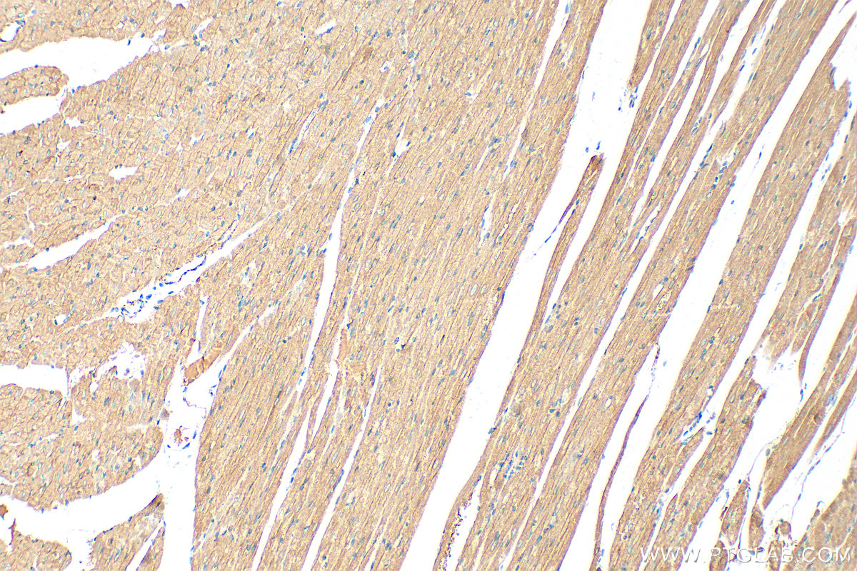 Immunohistochemical analysis of paraffin-embedded rat heart tissue slide using 21527-1-AP (MYLK3 antibody) at dilution of 1:800 (under 10x lens). Heat mediated antigen retrieval with Tris-EDTA buffer (pH 9.0). IHC staining of rat heart using 21527-1-AP