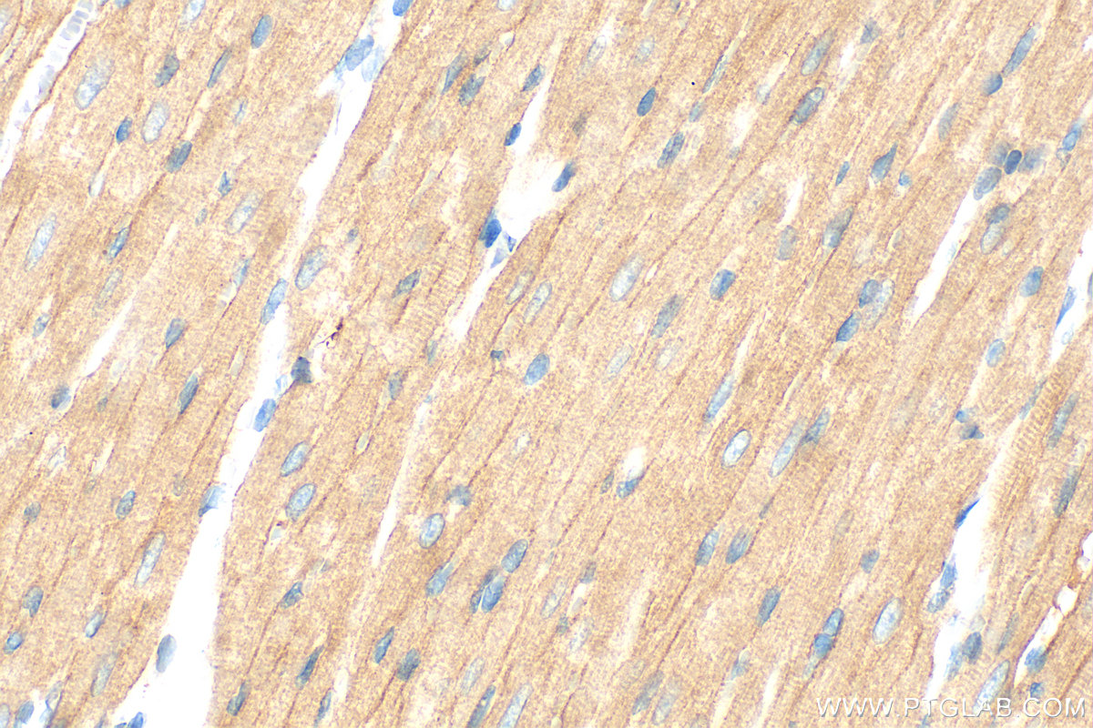 Immunohistochemical analysis of paraffin-embedded rat heart tissue slide using 21527-1-AP (MYLK3 antibody) at dilution of 1:800 (under 40x lens). Heat mediated antigen retrieval with Tris-EDTA buffer (pH 9.0). IHC staining of rat heart using 21527-1-AP