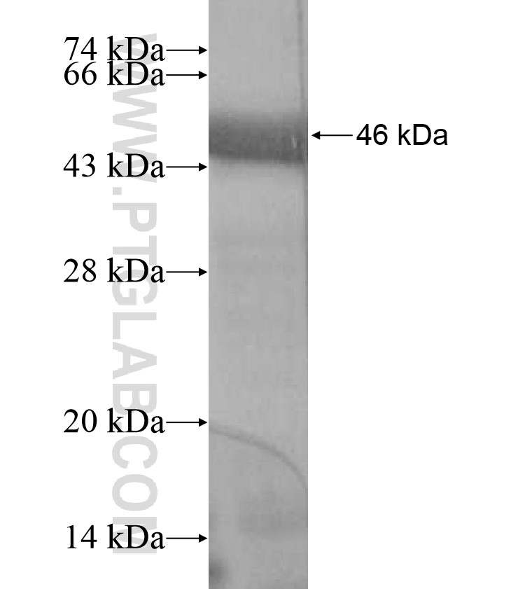 MYLK3 fusion protein Ag17370 SDS-PAGE MYLK3 fusion protein Ag17370 SDS-PAGE