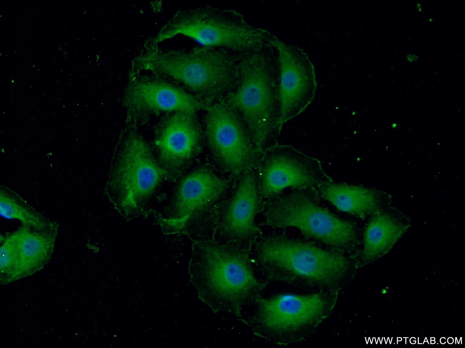 IF Staining of SH-SY5Y using 24565-1-AP