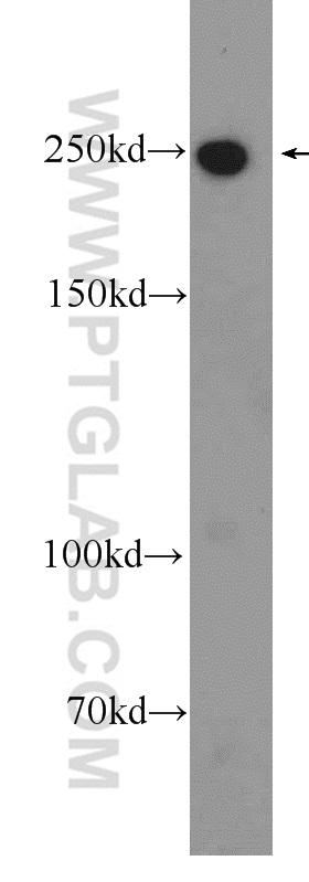 WB analysis of mouse brain using 24565-1-AP