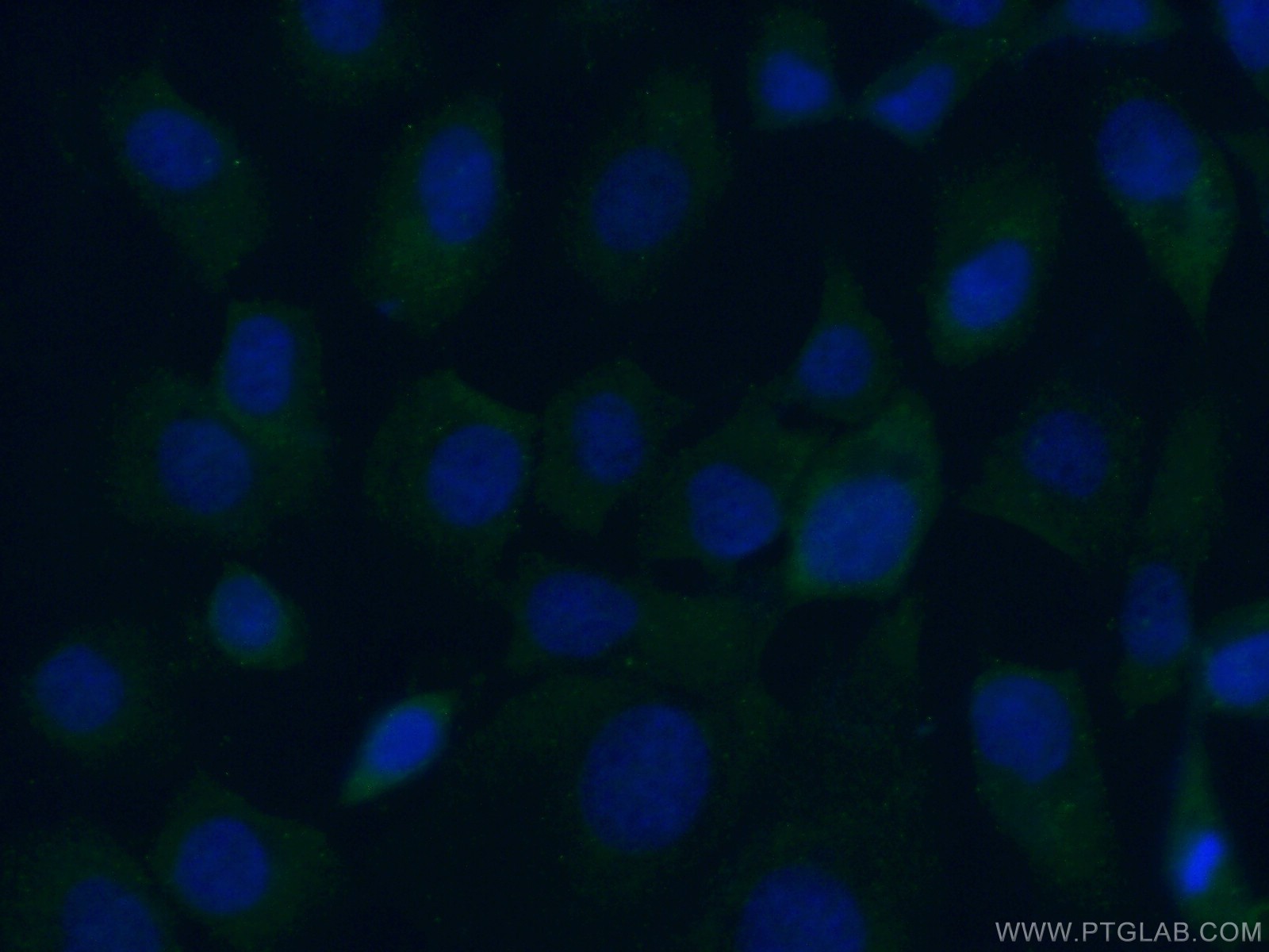 IF Staining of A431 using 18828-1-AP