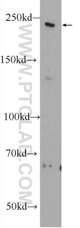 WB analysis of rat brain using 25104-1-AP