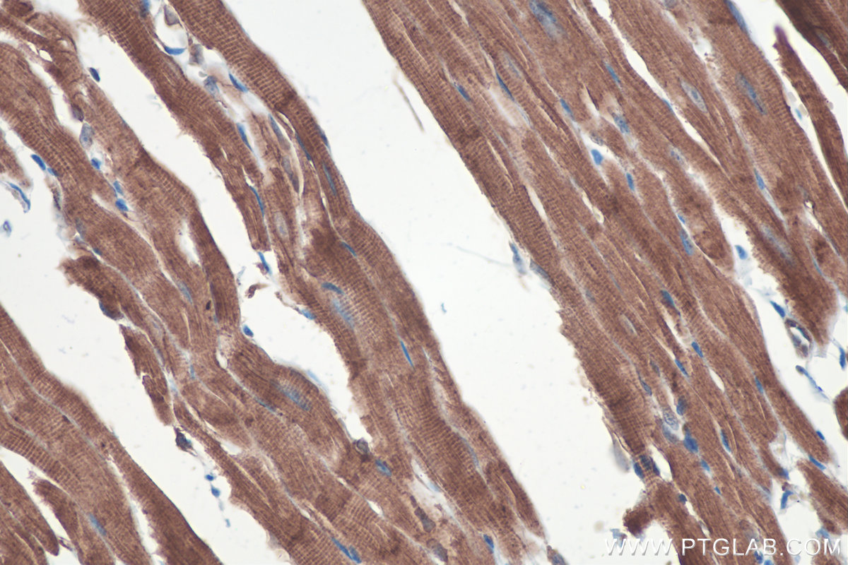 IHC staining of mouse heart using 14611-1-AP