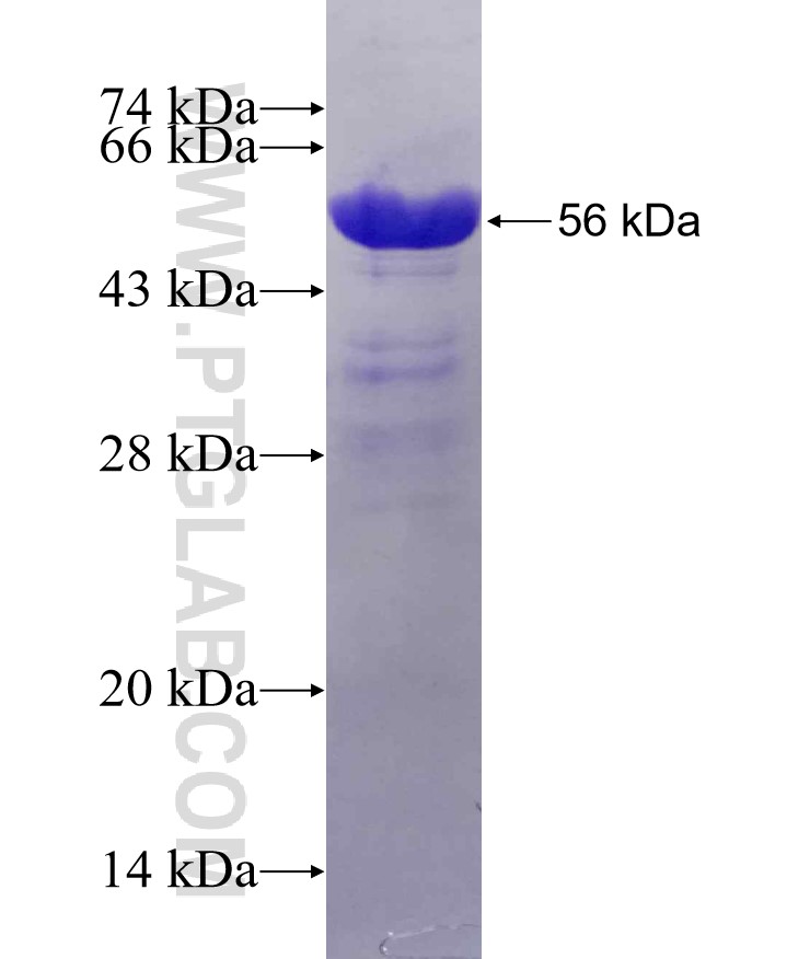 MYO18A fusion protein Ag6185 SDS-PAGE