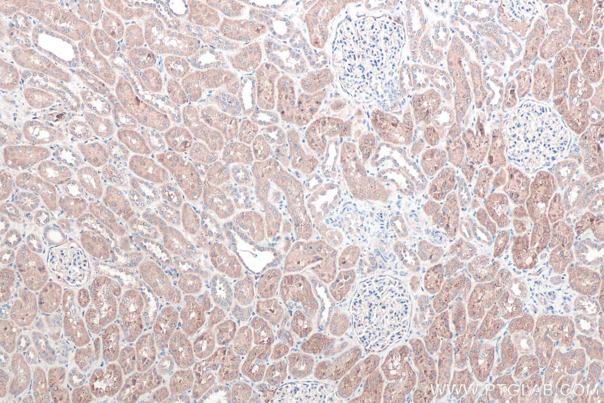 IHC staining of human kidney using 23906-1-AP