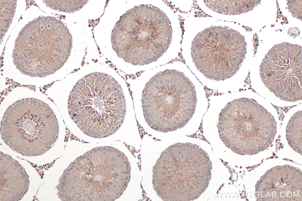 IHC staining of rat testis using 23906-1-AP